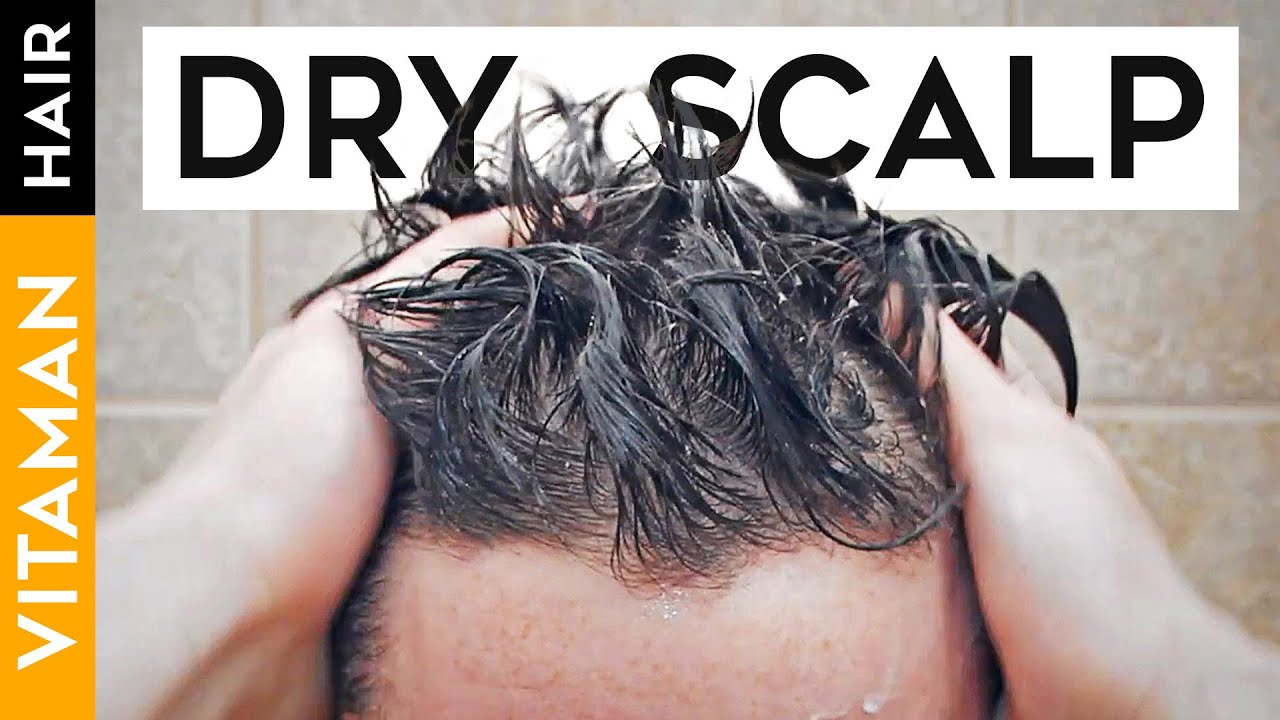 Effective Ways to Fix Dry Scalp in 2025: Discover Proven Solutions for Lasting Relief