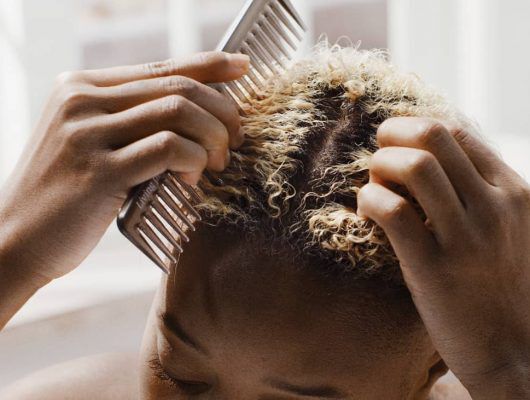 How to Fix Dry Scalp