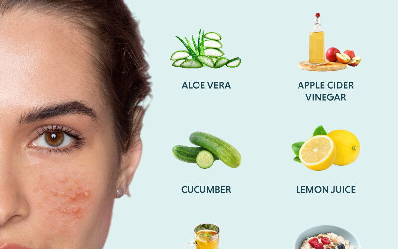 Effective Ways to Remove Pimples Overnight: Smart Tips for Clear Skin in 2025