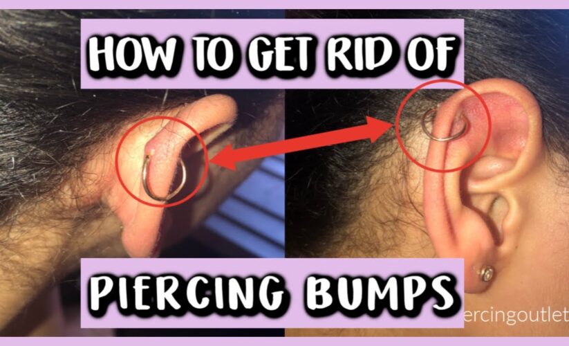 Effective Ways to Remove Piercing Bumps in 2025: Proven Methods to Succeed