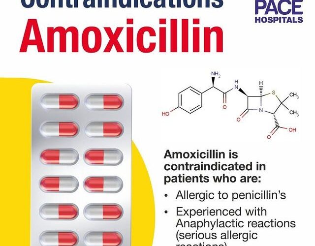 Effective Ways to Gauge How Long Amoxicillin Takes to Work: Get Results by 2025!