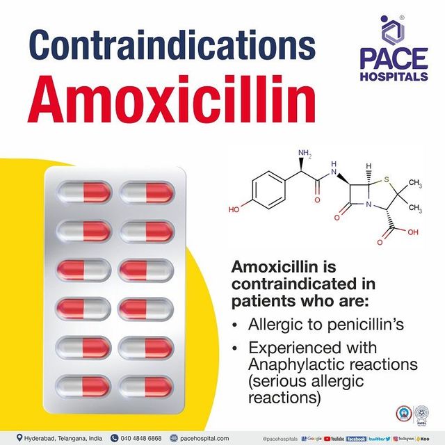 Effective Ways to Gauge How Long Amoxicillin Takes to Work: Get Results by 2025!