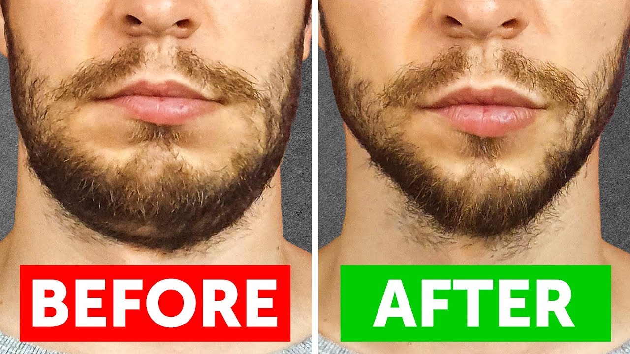 Smart Ways to Reduce Face Fat and Enhance Your Jawline in 2025