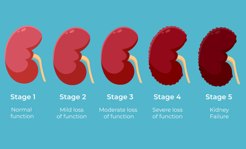 How to Properly Check Kidney Function at Home: 5 Effective Methods for Health Monitoring in 2025